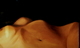 Naked Hills